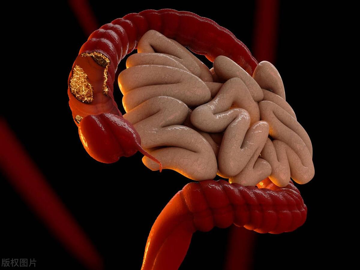 梅毒的潜伏期有多长时间 梅毒的潜伏期是多久?什么症状?(图4)